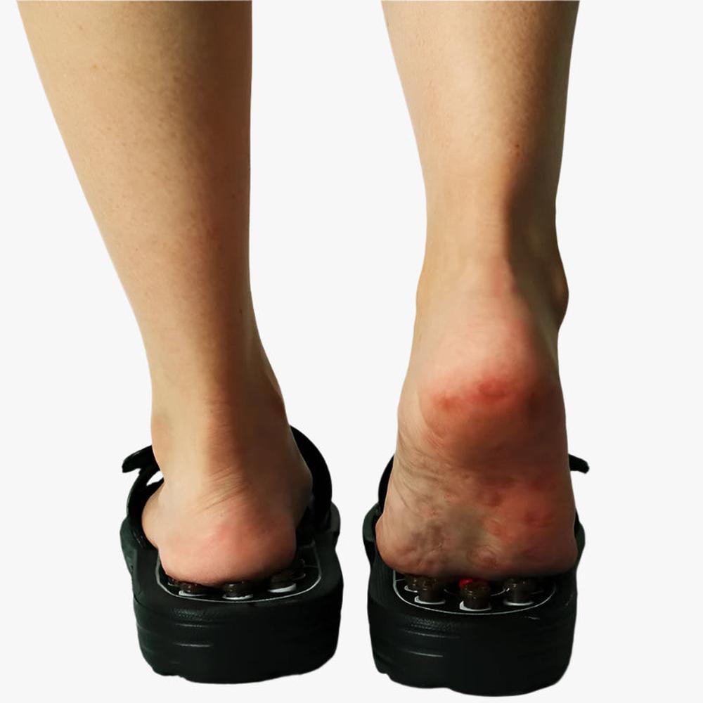 Acupressure Massage Slippers for Therapeutic Foot Relief - Unisex Comfort